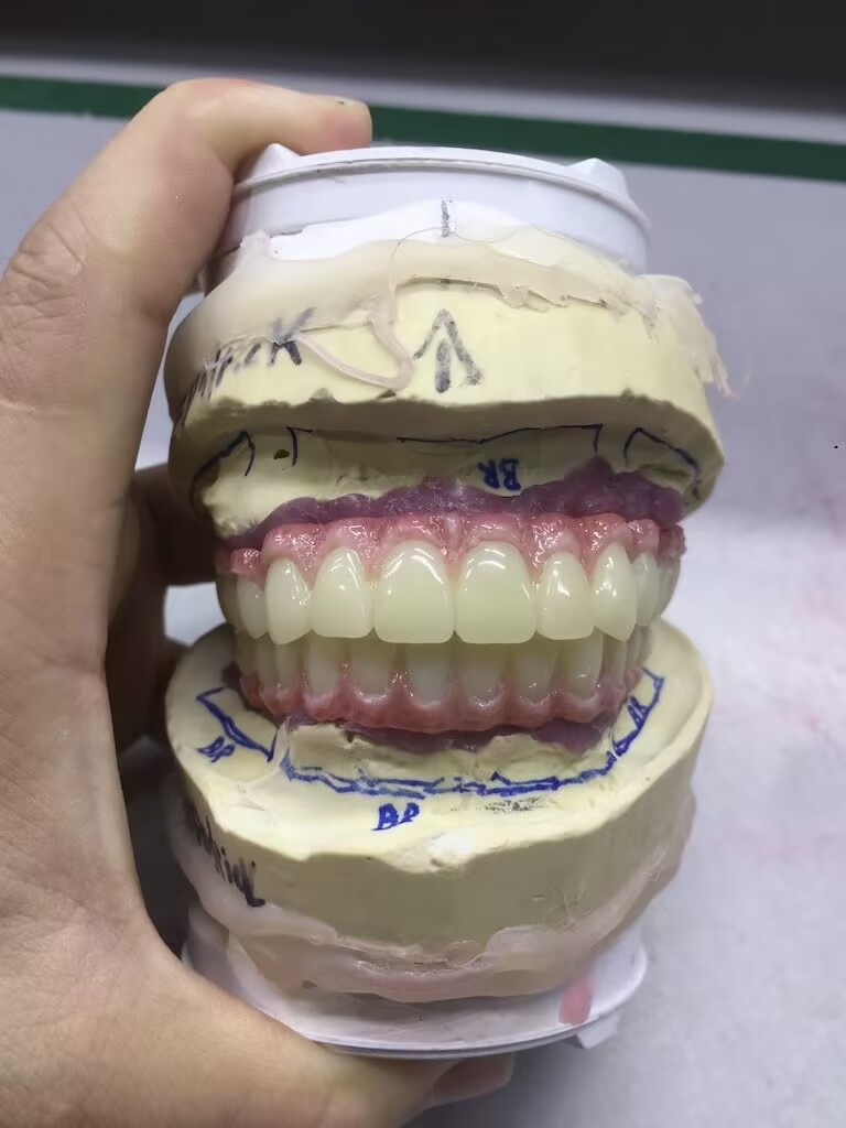 All-Zirconia Screw-R